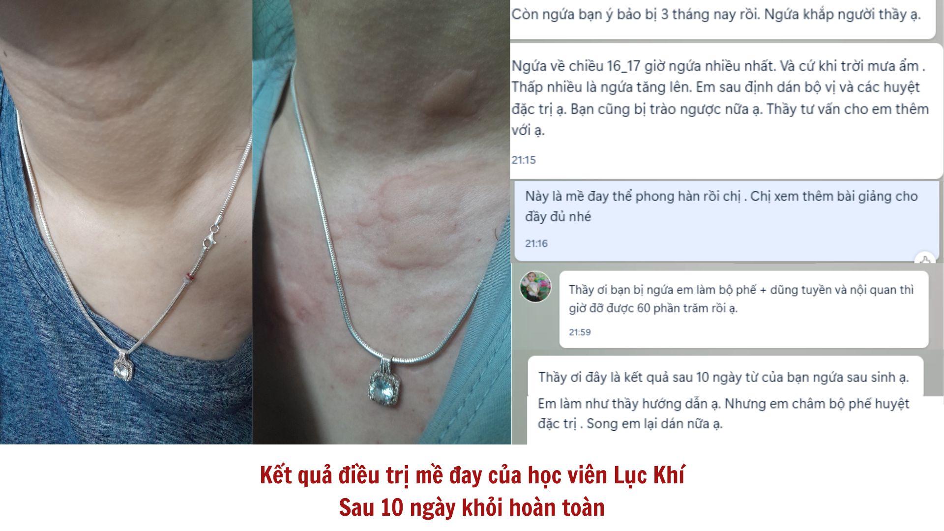 Kết quả 14